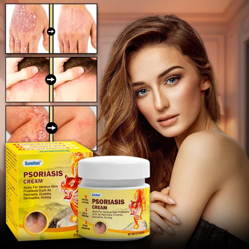 الدهان السحري للصدفية والأكزيما